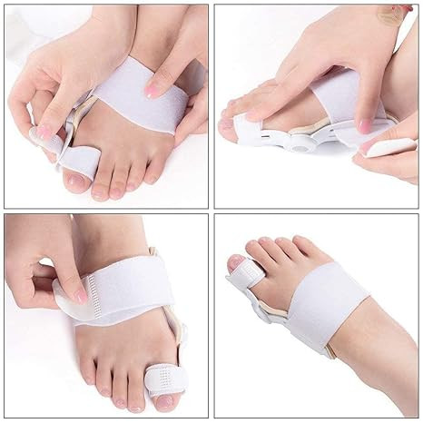 Complete Orthopedic Bunion Corrector and Relief Kit for Foot (1 pice 490 tk)